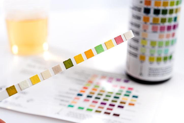 Urinalysis
